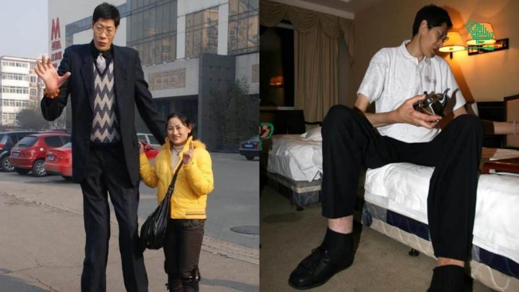 Top 10 Tallest People In The World Today | Saudi Scoop