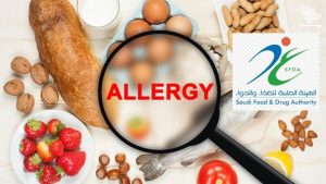 causes-food-allergies-sfda-saudiscoop